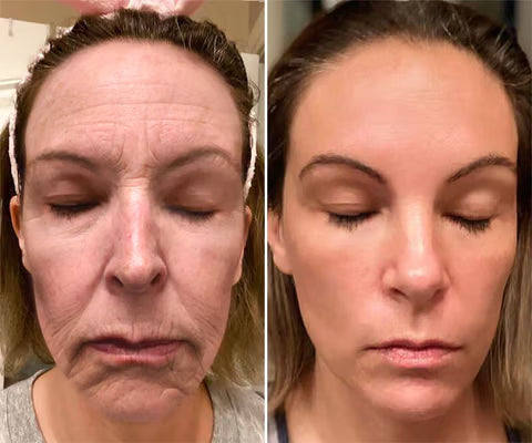 Botox Bee Venom Anti-Aging And Wrinkle Removing Cream