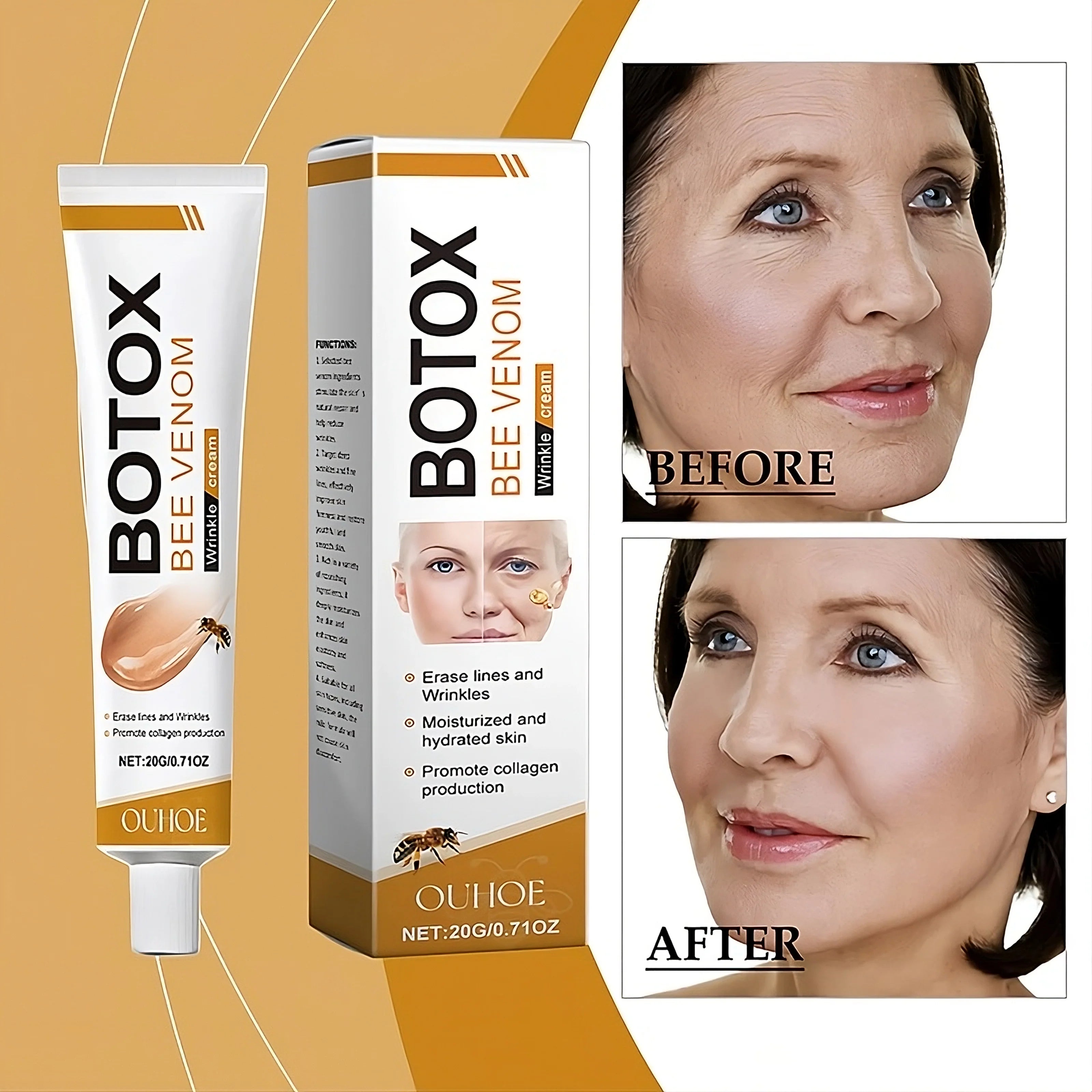 Botox Bee Venom Anti - Aging And Wrinkle Removing Cream - Miraaj