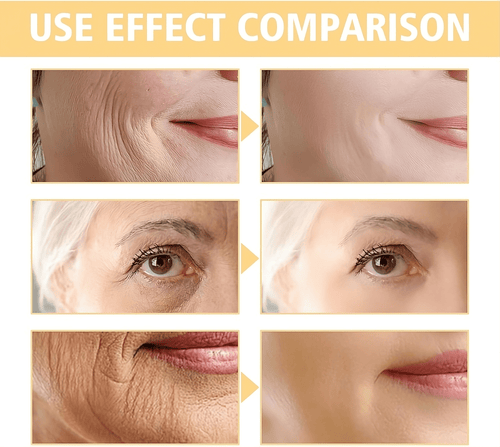 Botox Bee Venom Anti - Aging And Wrinkle Removing Cream - Miraaj